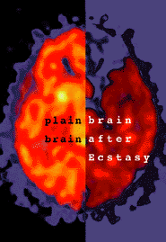 Brain on Ecstasy